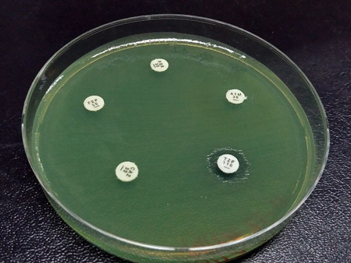 Drug resistant bacteria - picture of them in some kind of green liquid